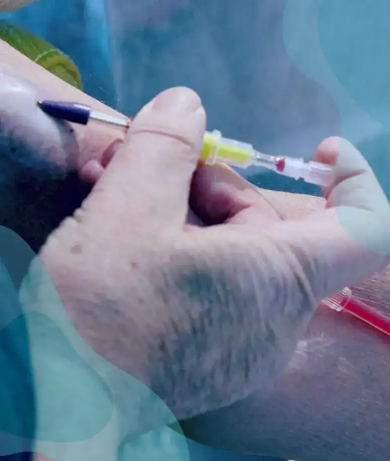 hemodialyse a domicile principe